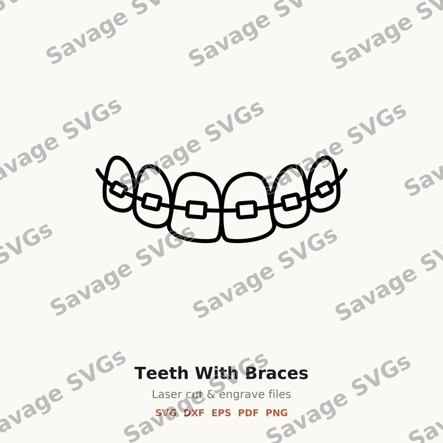 Teeth With Braces