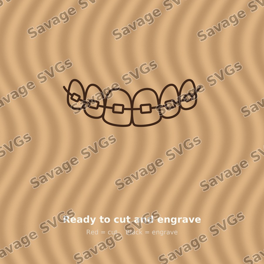 Teeth With Braces