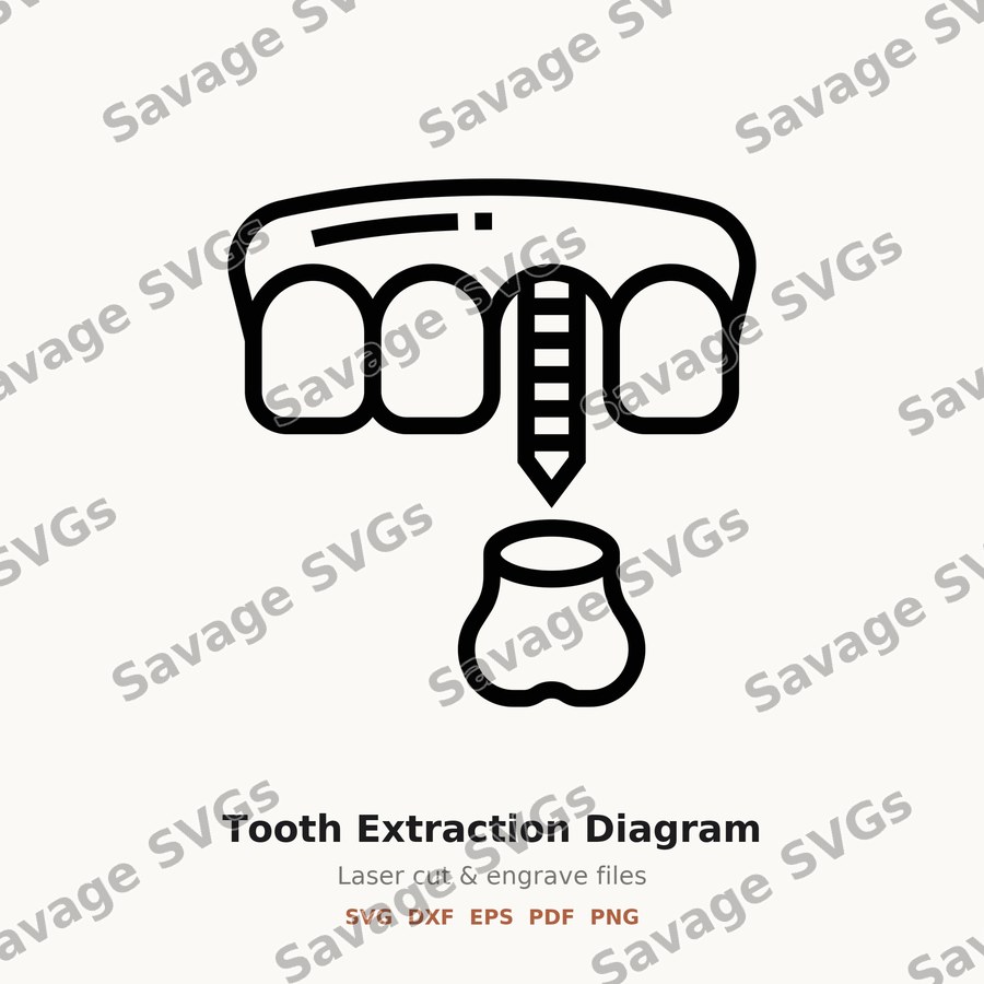 Tooth Extraction Diagram